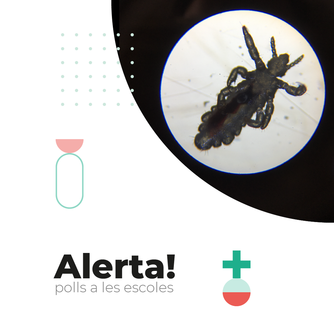 ¿Piojos? Encuentra la solución en nuestra farmacia!